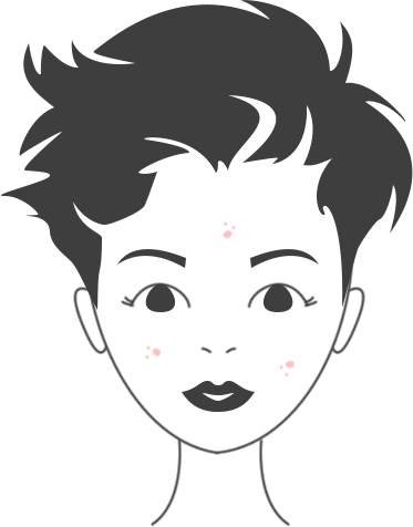 Acne- or blemish-prone or impure Skin